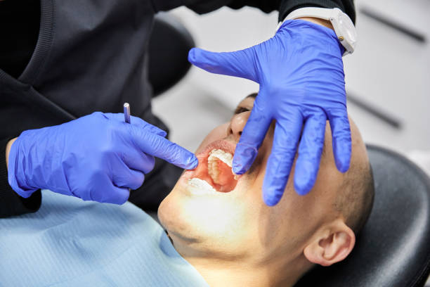 Best Broken or Chipped Tooth Repair in Boyes Hot Springs, CA