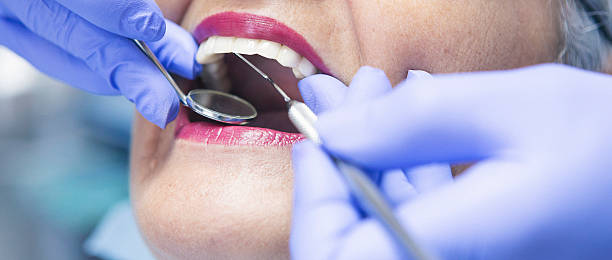 Best Emergency Dental Care for Sports Injuries in Boyes Hot Springs, CA